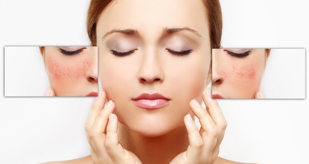 Analizador de piel facial - AurelijosSPA