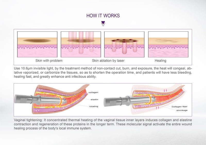 CO2 Fractional Laser Machine